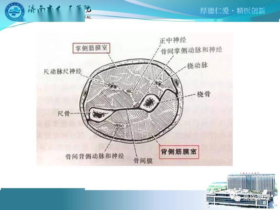 【ppt】骨筋膜室综合症的观察及护理