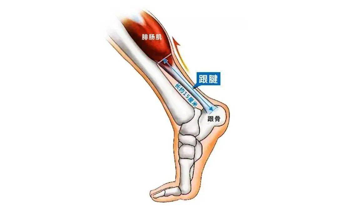 一文读懂如何预防运动性跟腱断裂