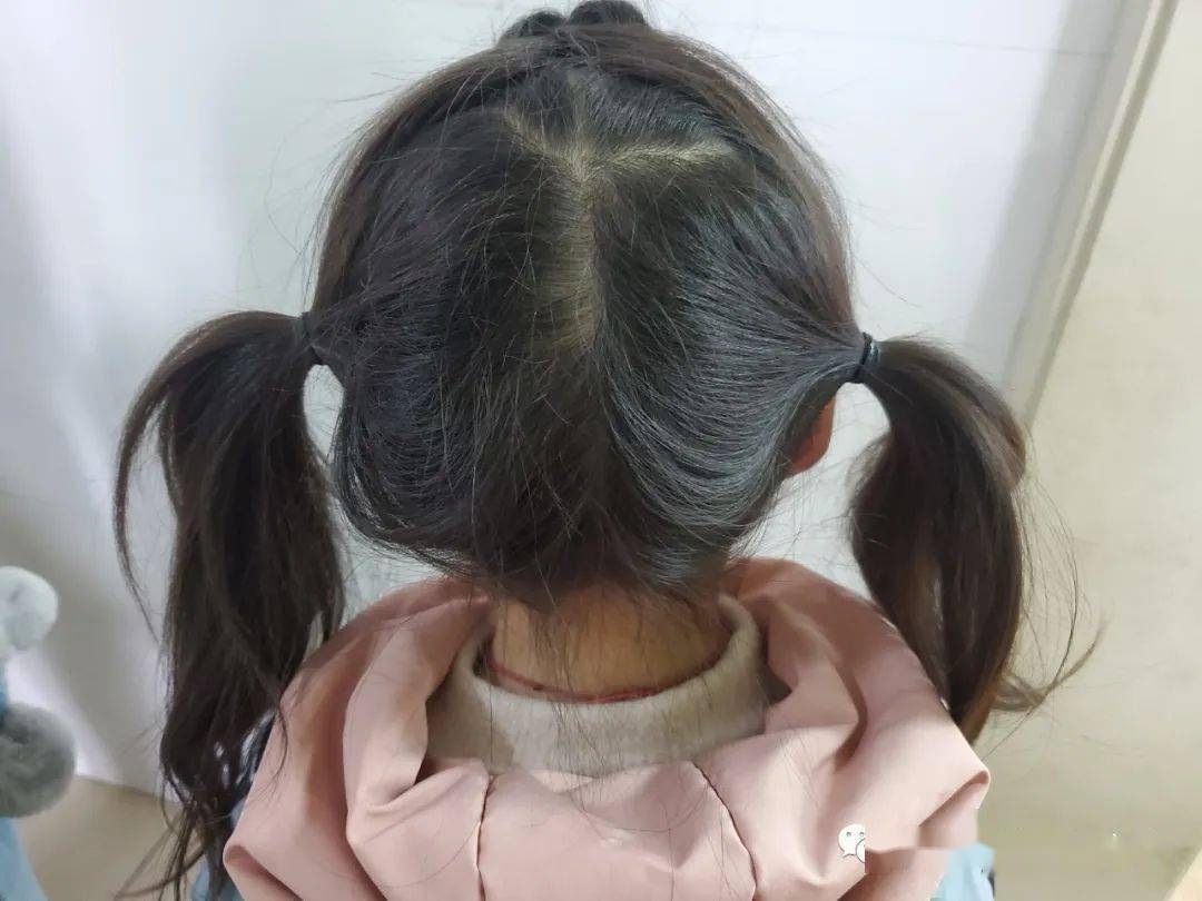 孩子的问题:为什么头发总是梳不平,乱糟糟的?