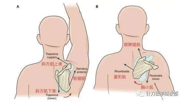抬臂上不去不可忽视肩胛骨的上下回旋