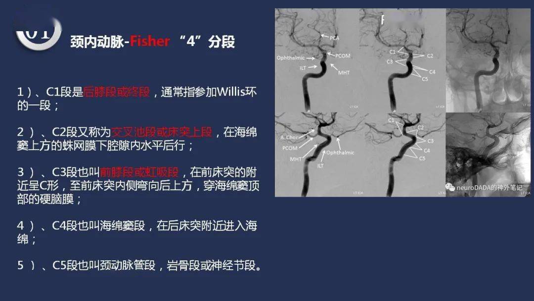 【深度学习】高清头颈动脉系统解剖