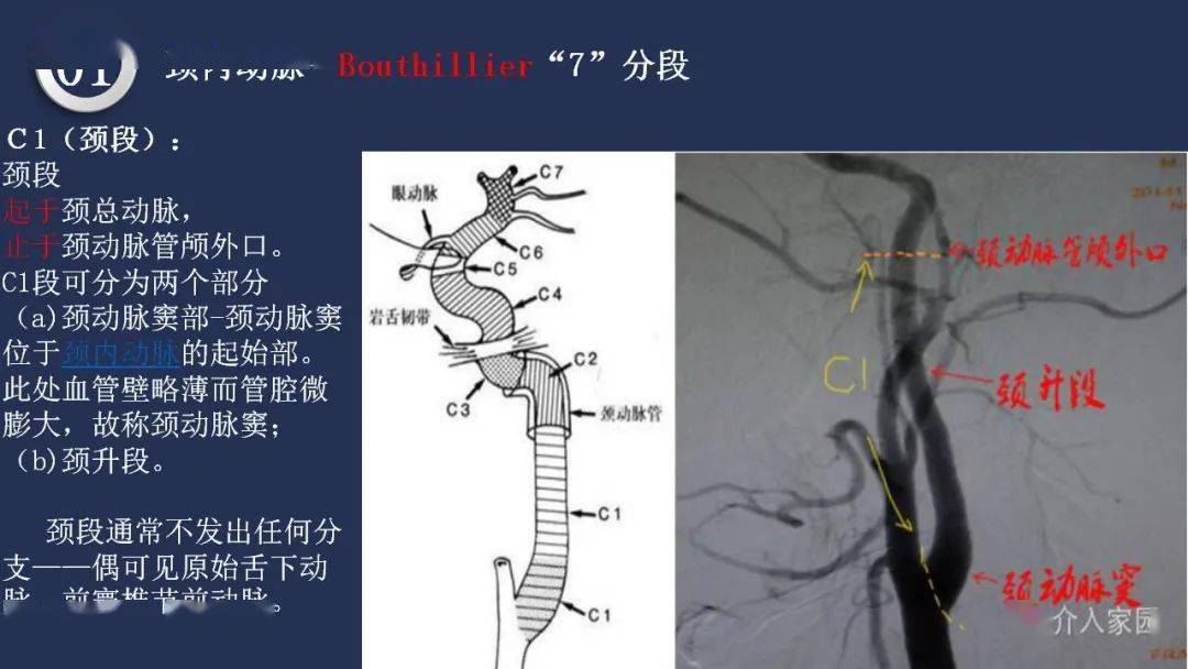 【深度学习】高清头颈动脉系统解剖