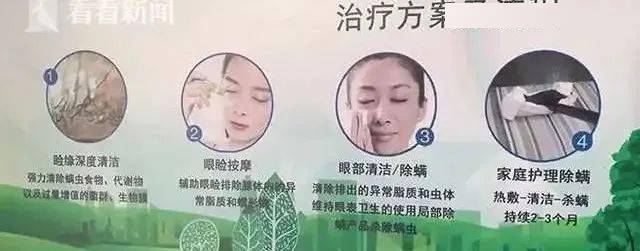 这其中有一部分人群就是因为  螨虫性的睑缘炎造成干眼