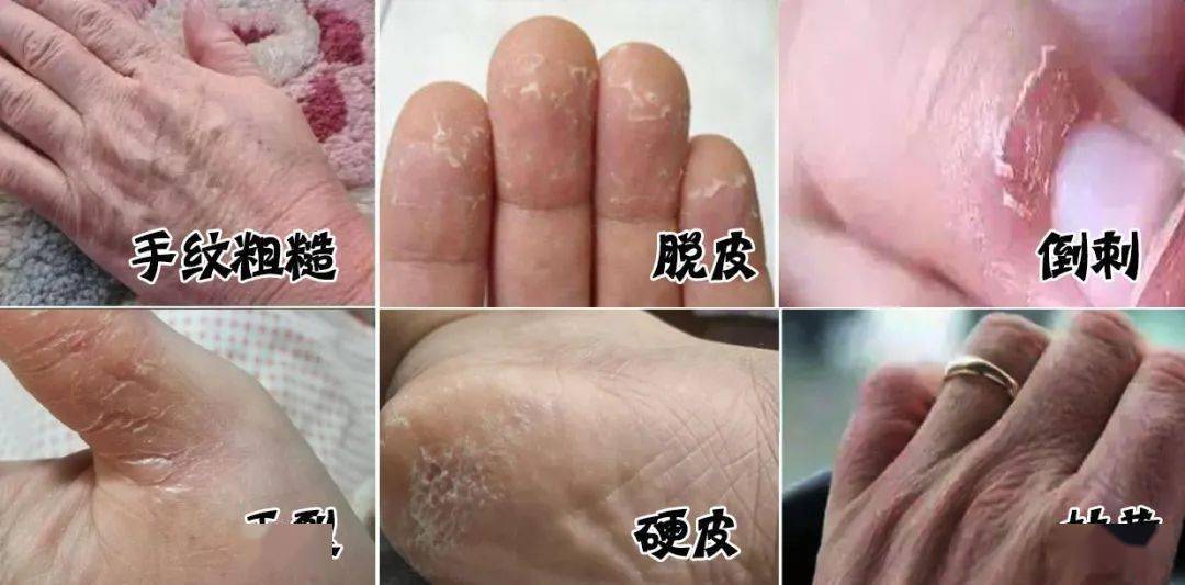 一支解决手部干裂粗糙暗沉的护手霜坚持用一个冬天手嫩到你不认识它
