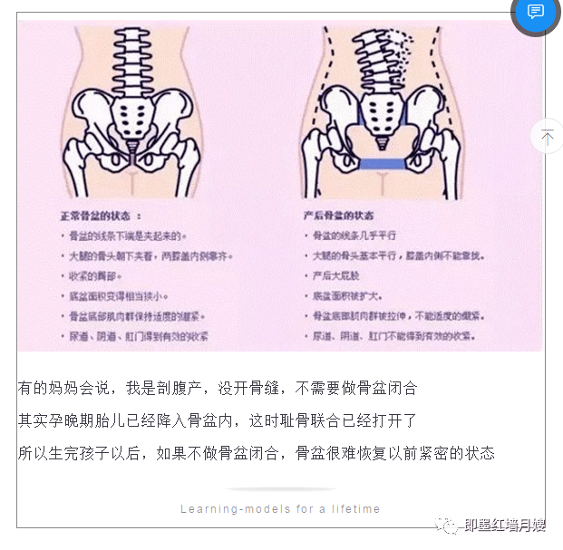 骨盆篇骨盆闭合您真的了解吗