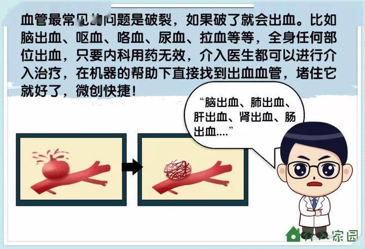 漫画科普│什么叫介入治疗?介入医生是做什么的?