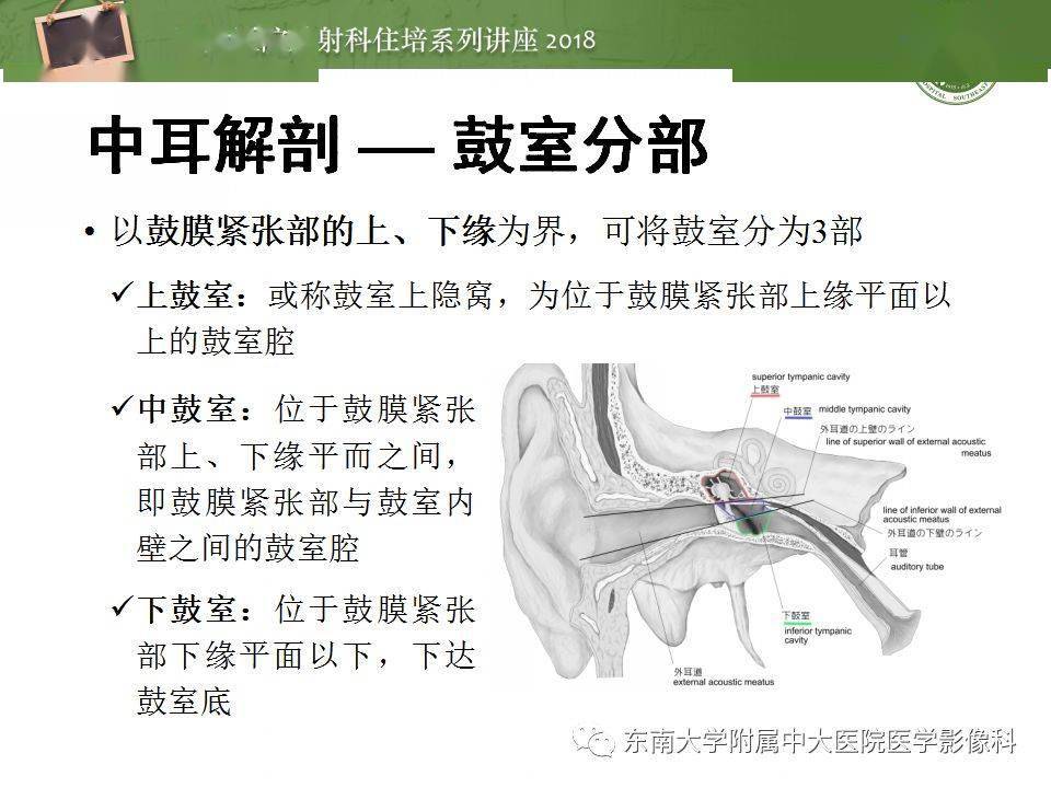 中耳解剖及中耳病变影像诊断