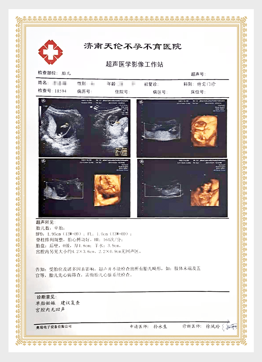 右侧单角子宫 左侧残角子宫 双侧输卵管堵塞,2次自然怀孕,儿女双全!