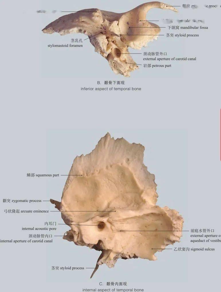 internal aspect of parietal bone图1-14 顶骨内面