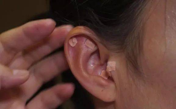 耳朵上出现这些特征是大病的征兆