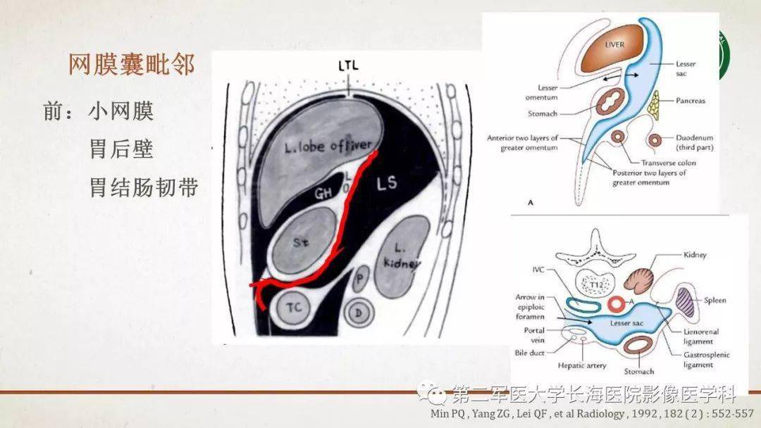 腹膜相关结构的影像解剖_肠系膜