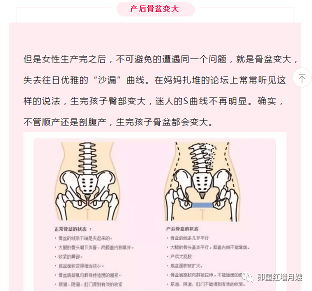 【骨盆篇】产后骨盆变形,这些危害您知道吗?