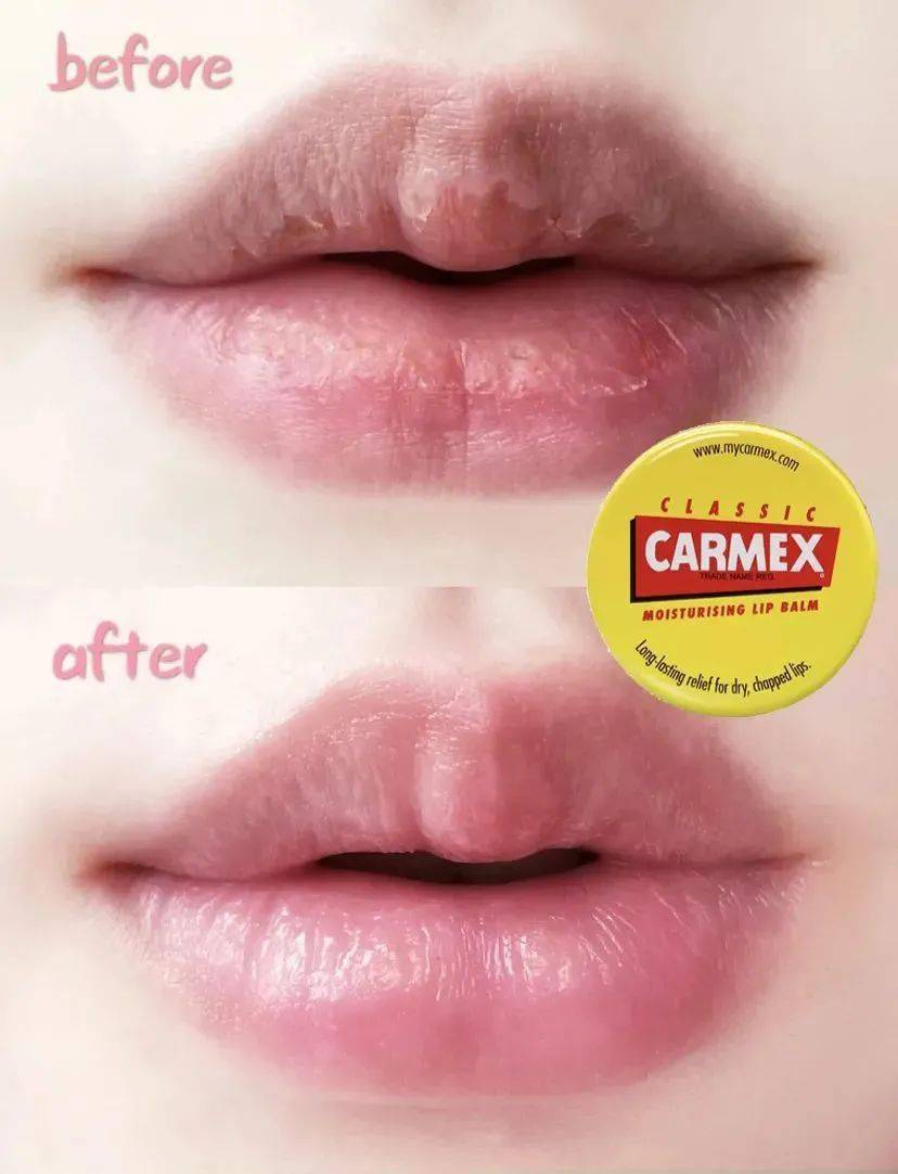 唇什么什么白成语_成语故事简笔画(4)