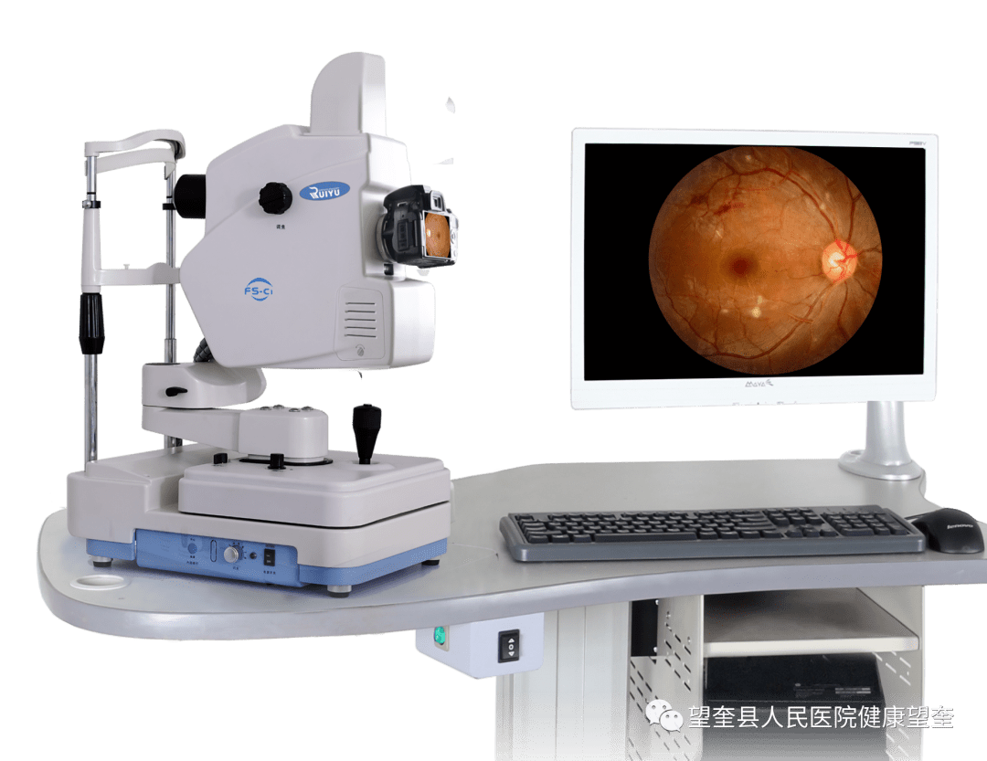 fs-c1免散瞳彩色眼底照相机眼底照相检查的意义眼底照相检查是通过