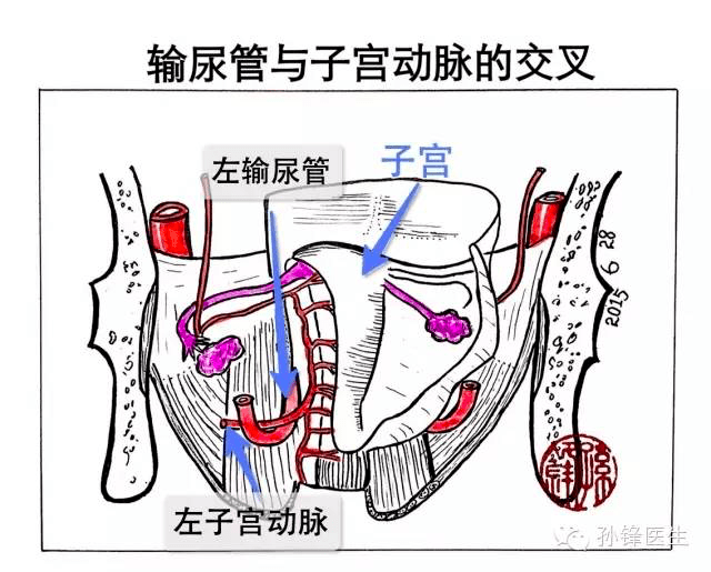 这一次交叉同样实现了输尿管由背侧向腹侧的位置变化,见下图(4).