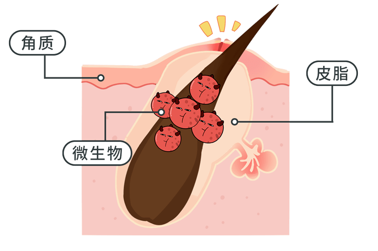 一般皮脂腺发达