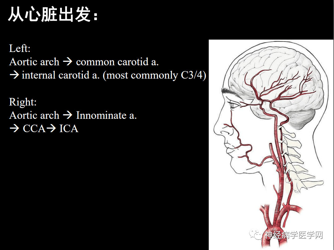 脑血管之当解剖遇到临床