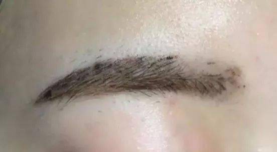 确实,第一次做完眉掉完痂后,眉毛没有颜色了.