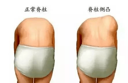 2cfe9381e6c24bd288aff45673d28868.png
