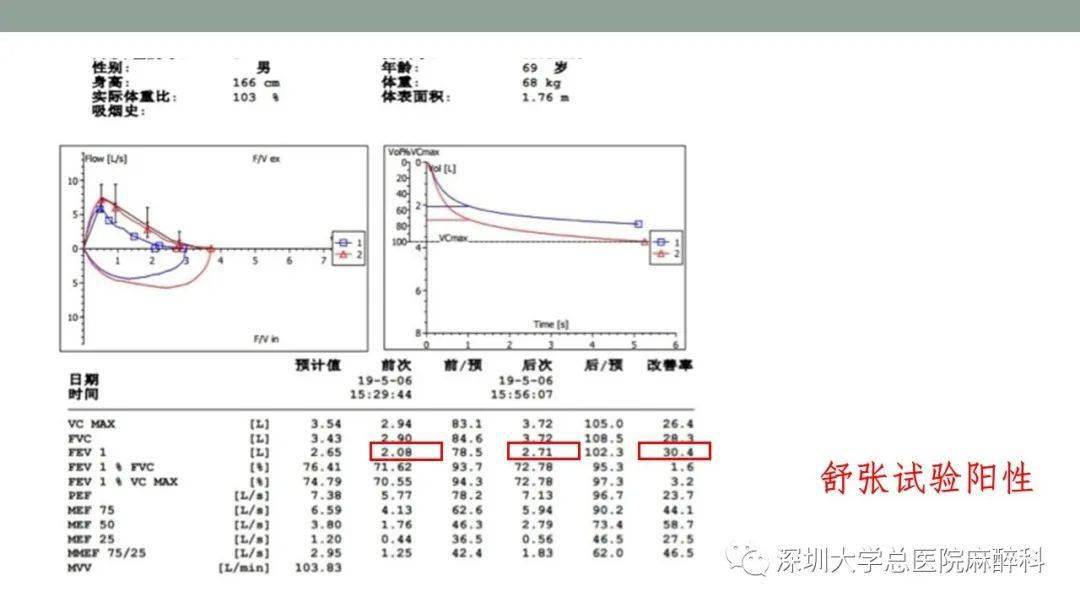 肺功能检查解读 | 实用_试验