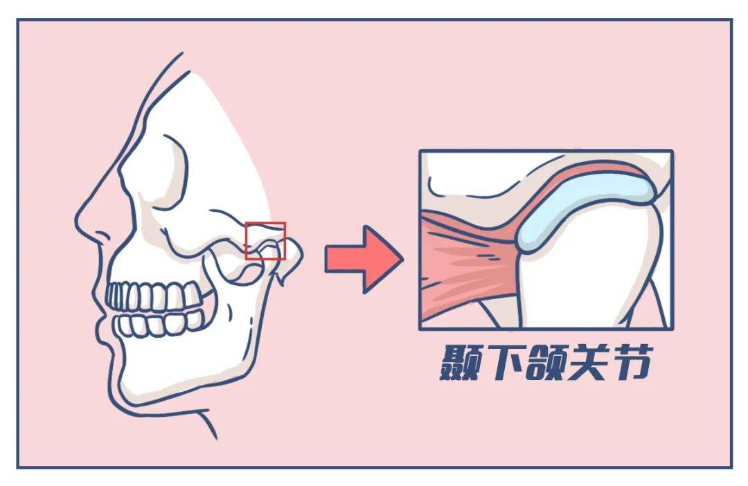 着几条肌肉我们的下巴才可以上下,左右,前后移动tmd:颞下颌关节紊乱症