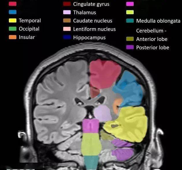 cingulate, 顶叶 temporal 颞叶 occipital 枕叶 insular 岛叶 cingulate