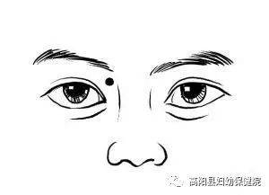 睛明穴位于目内眦(内眼角)稍上方的凹陷中.