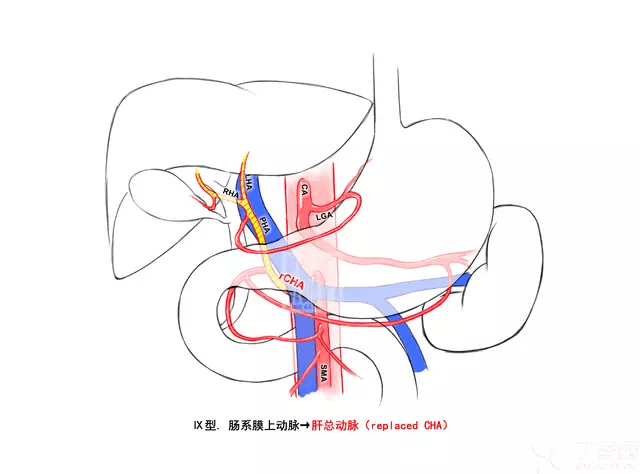 肝动脉之舞