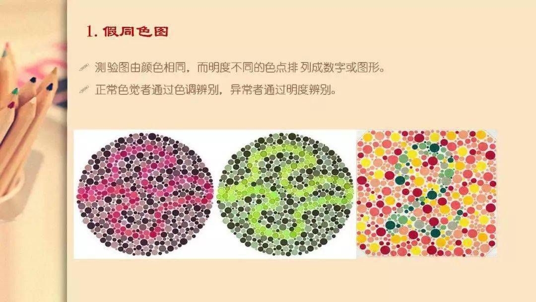【眼视光】 色觉异常的分类及检查