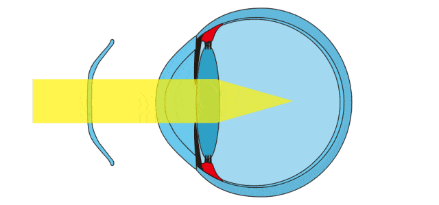 请查收这份近视防控