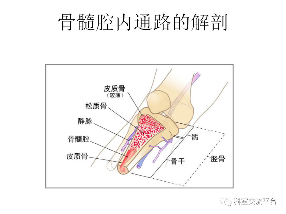 wow,增强扫描可以不经静脉?骨髓腔内注射你一定要了解