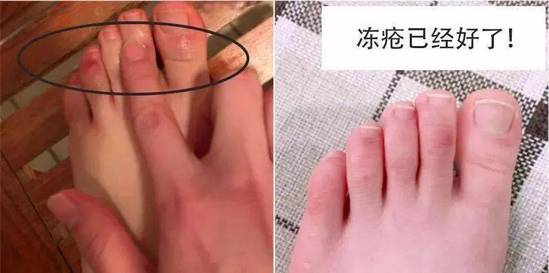 白天刮丝袜,晚上刮被子,让男友暖脚也被嫌弃!