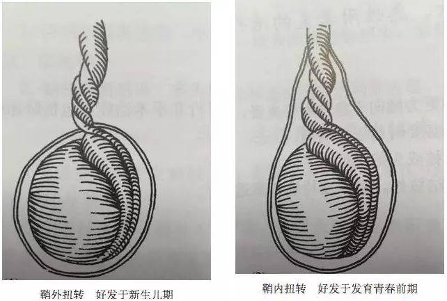 14岁少年一忍再忍,结果悲剧了……_睾丸