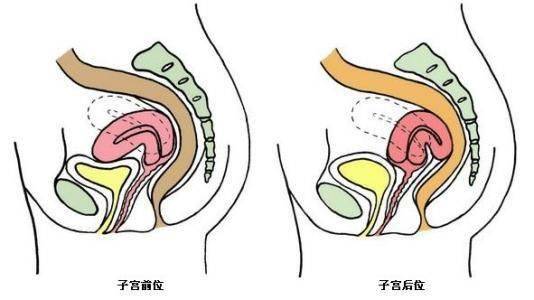 子宫在盆腔内的位置可分为前位子宫,中位子宫和后位子宫.