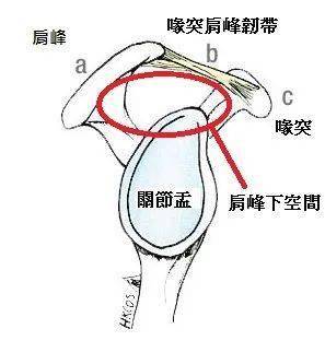 a为肩峰,b为喙突肩峰韧带,c为喙突,a,b,c连线形成屋顶,而肱骨头为基底