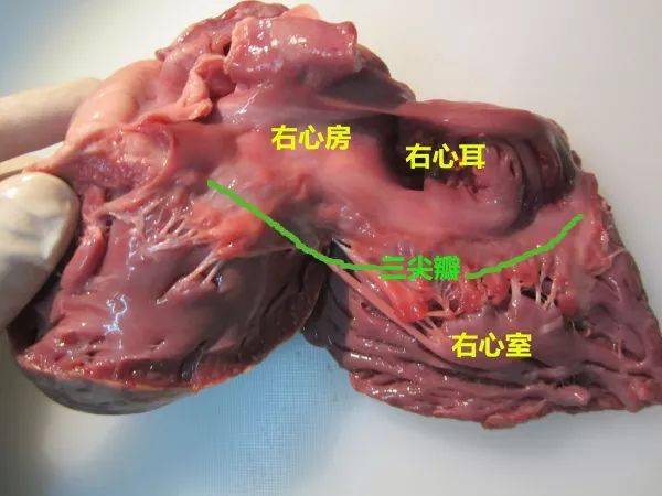 身为一名法医,我来实际解剖一颗心脏_冠状动脉