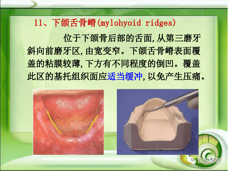 全口无牙颌解剖标志识别