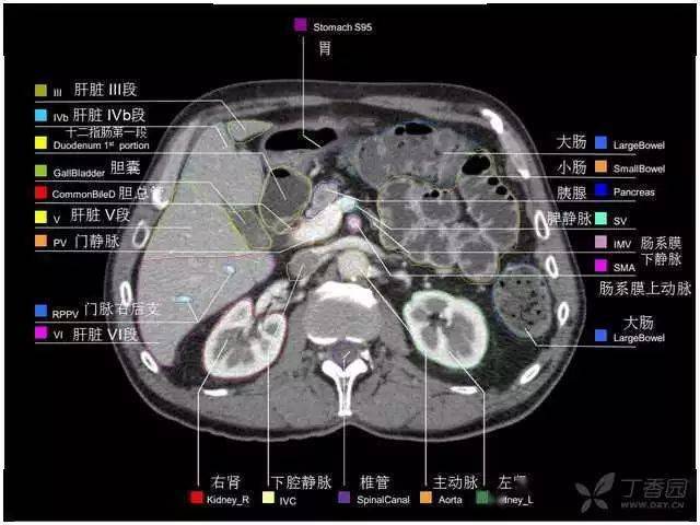 【收藏】史上最全的ct断层解剖图谱--一篇所有都有