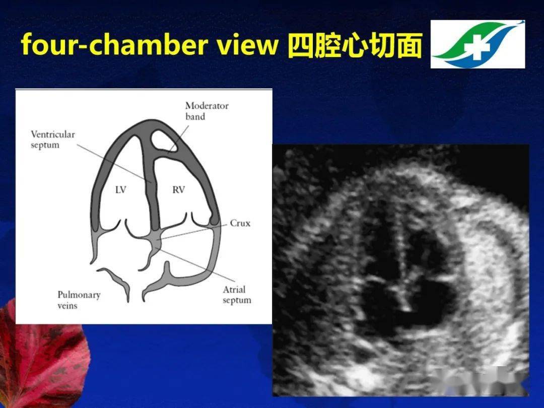 胎儿超声心动图基础及切面