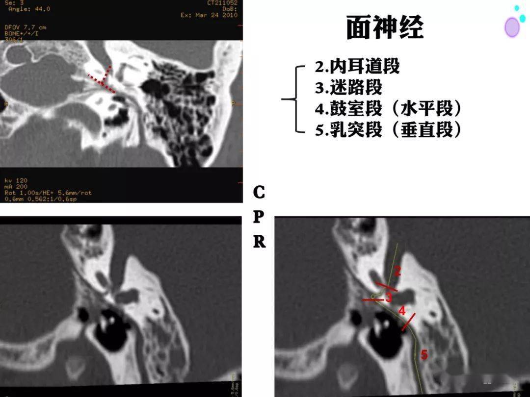 【收藏】史上最全的ct断层解剖图谱--一篇所有都有