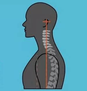 (1)正常的颈椎那么,我们也可以通过观察受检者端坐后其侧位颈椎的形态