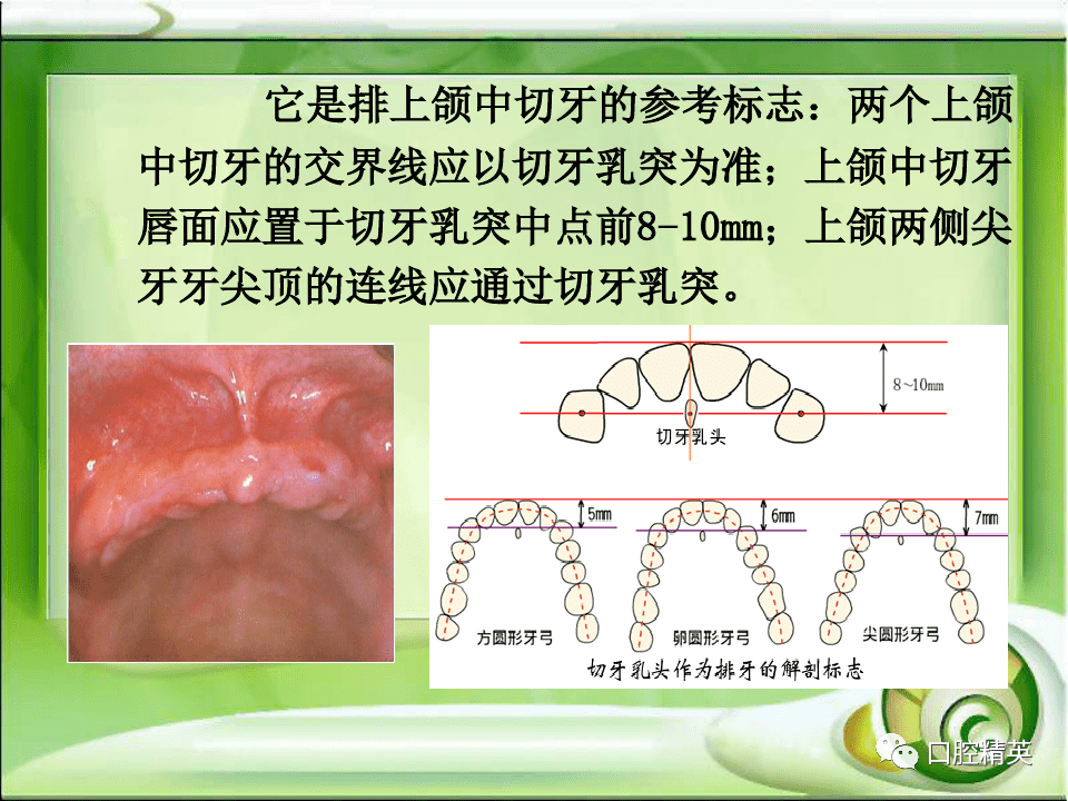 全口无牙颌解剖标志识别