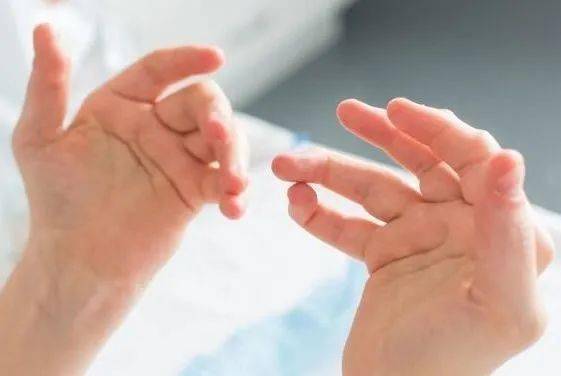 【筋骨堂】手指关节疼痛,变形是骨关节炎还是类风湿?