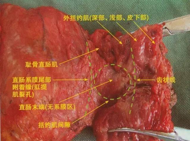 齿状线到底在哪里?