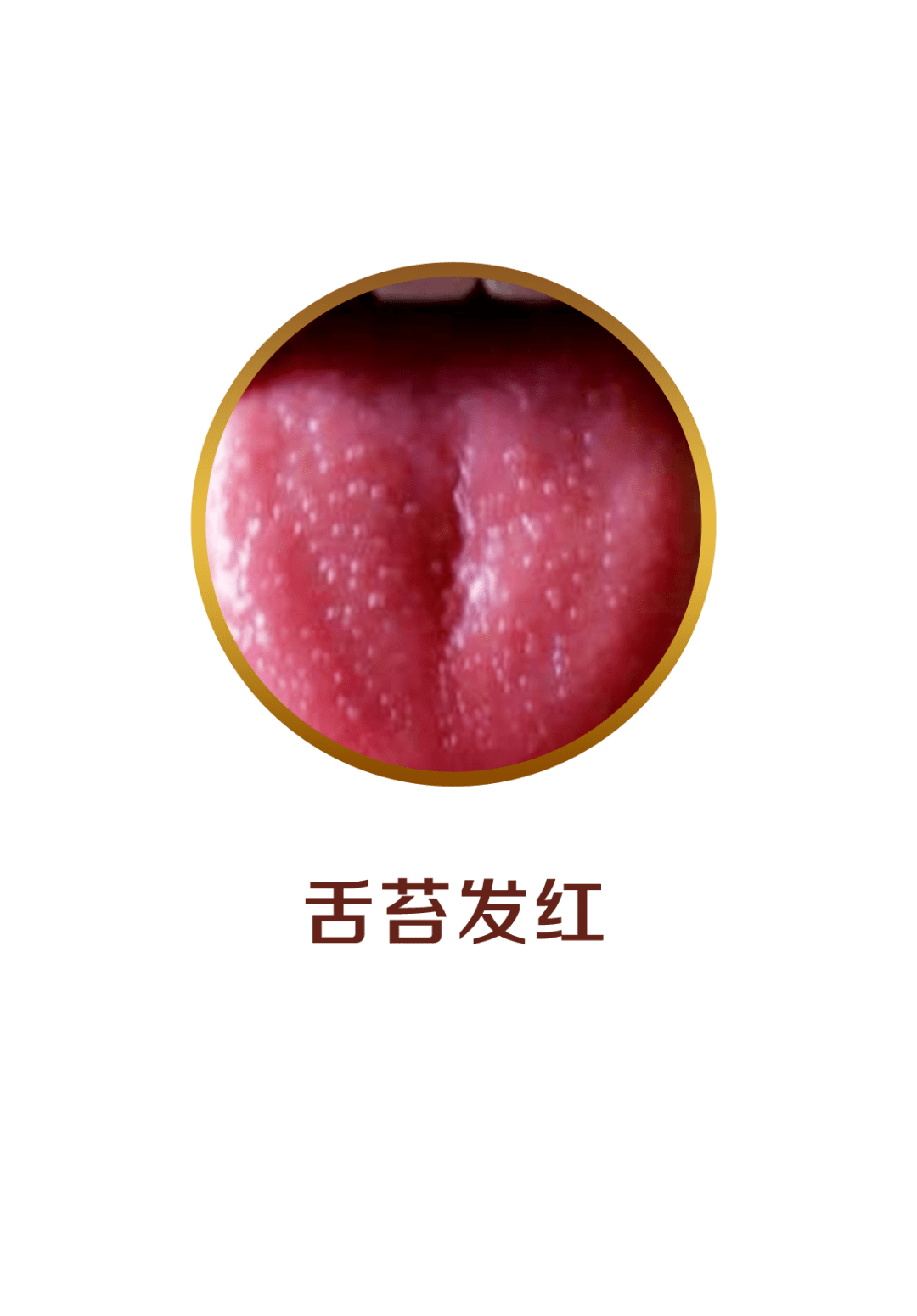 注意:这4种舌苔,是宝宝健康在预警!_舌头