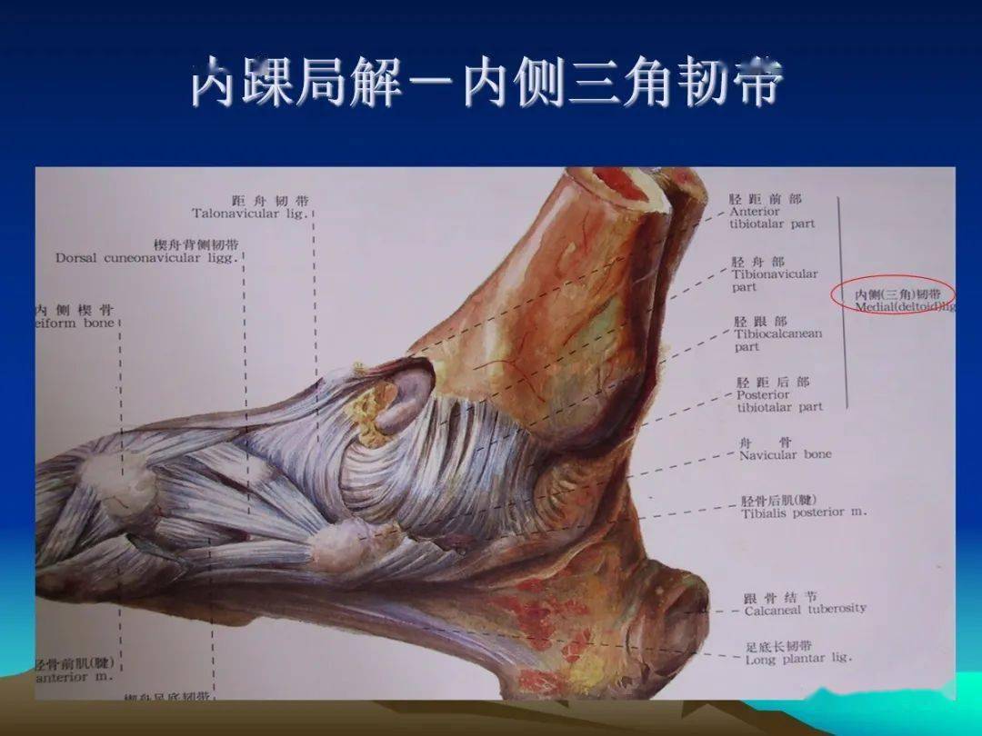 踝关节外侧韧带急性损伤的mri表现