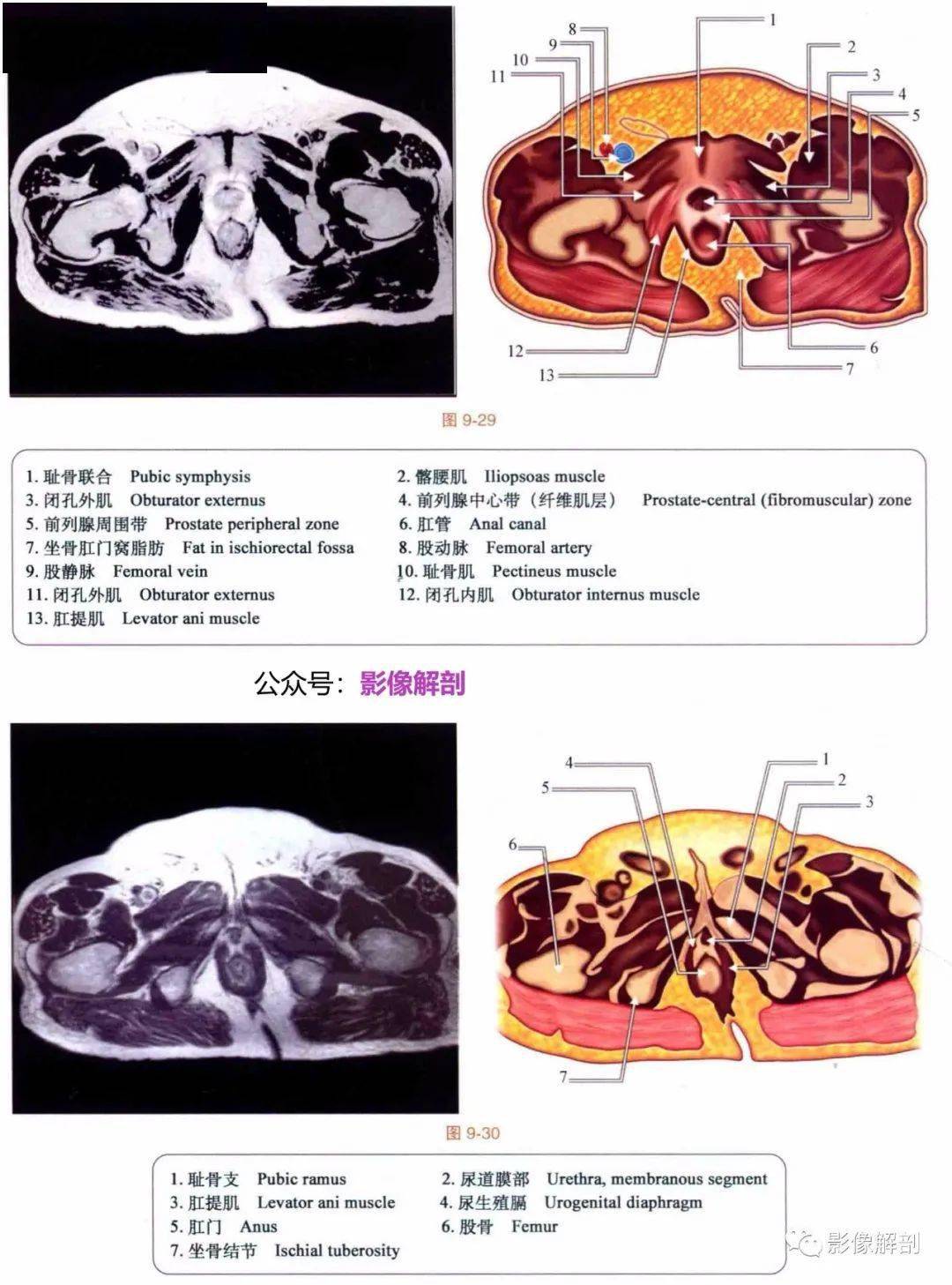 断层图谱 | 男,女性盆腔解剖图谱