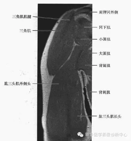 上臂磁共振解剖图谱