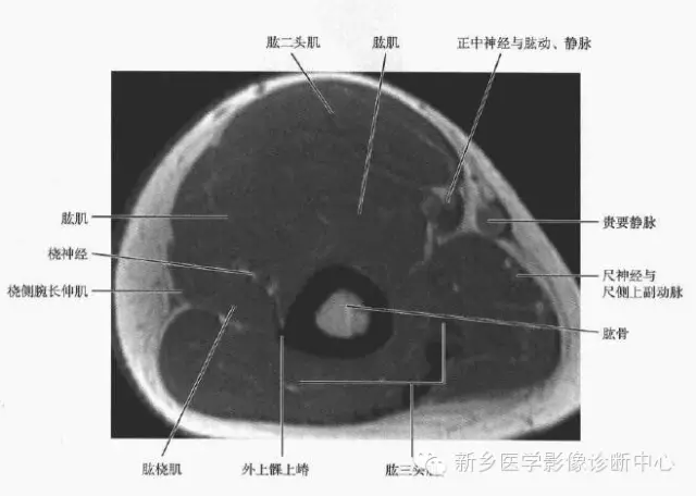 上臂磁共振解剖图谱