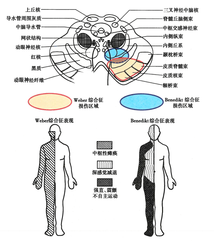 干货满满|神经解剖学习-脑干